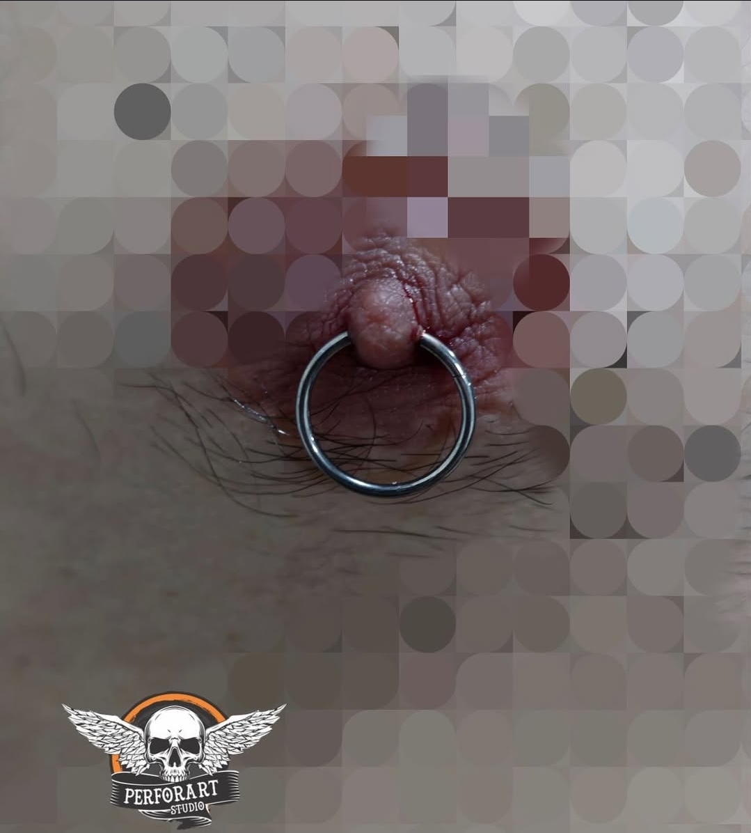 Nipple